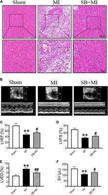 Targeting Glycogen Synthase Kinase 3 Beta Regulates CD47 Expression After Myocardial Infarction in Rats via the NF-κB Signaling Pathway